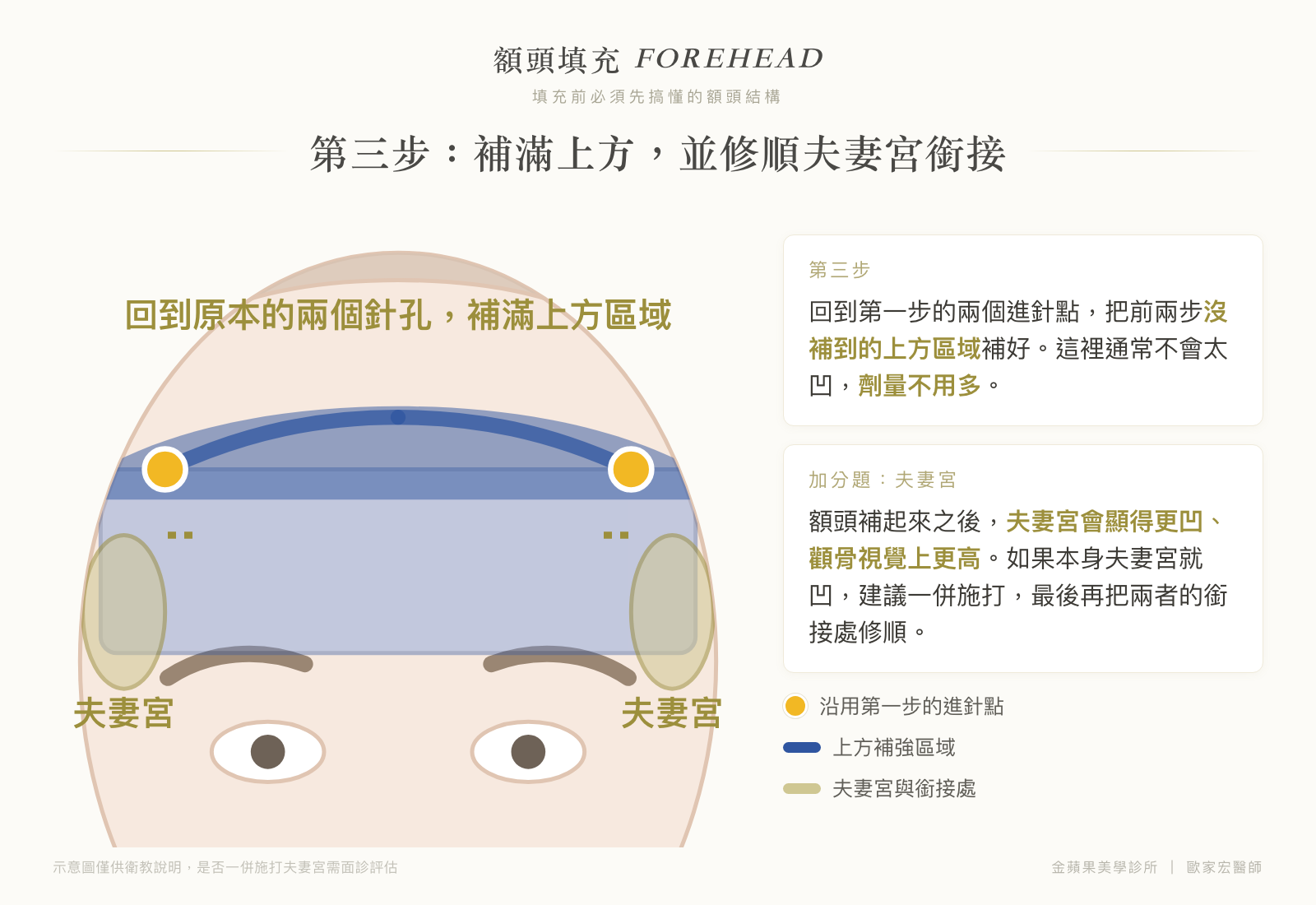 額頭填充第三步示意圖：回到原本兩個進針點補滿上方區域，並修順額頭與夫妻宮的銜接處