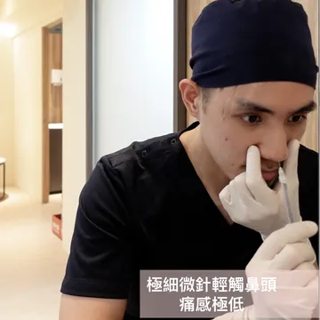 醫師以極細微針輕觸鼻頭進行鼻雕，圖上標註痛感極低