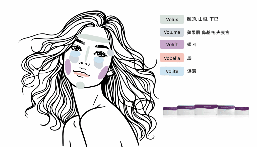 喬雅登玻尿酸