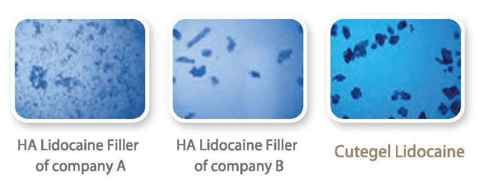 三款含麻玻尿酸顯微顆粒比較圖，右為Cutegel Lidocaine