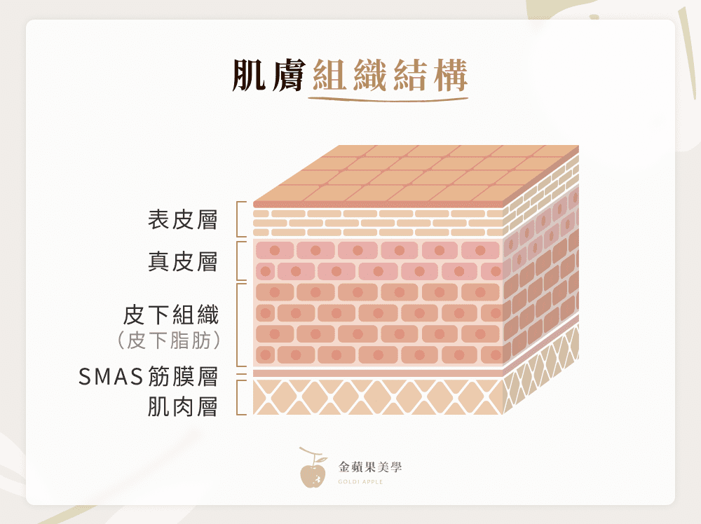 無痕筋膜拉提作用層次：肌膚組織結構與 SMAS 筋膜層