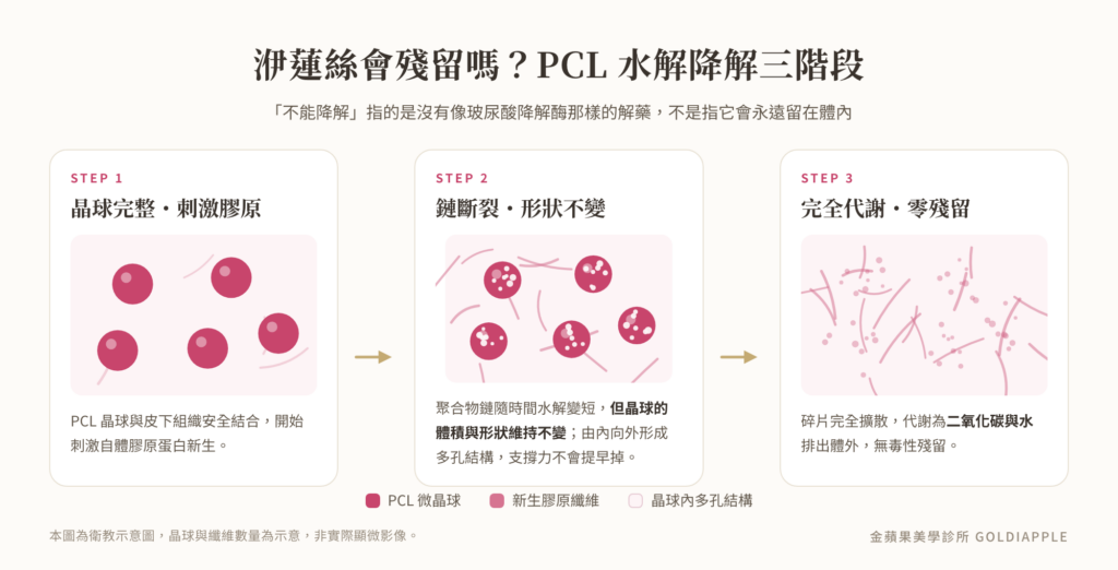 洢蓮絲 PCL 水解降解三階段示意圖：晶球完整、鏈斷裂形狀不變、完全代謝為二氧化碳與水
