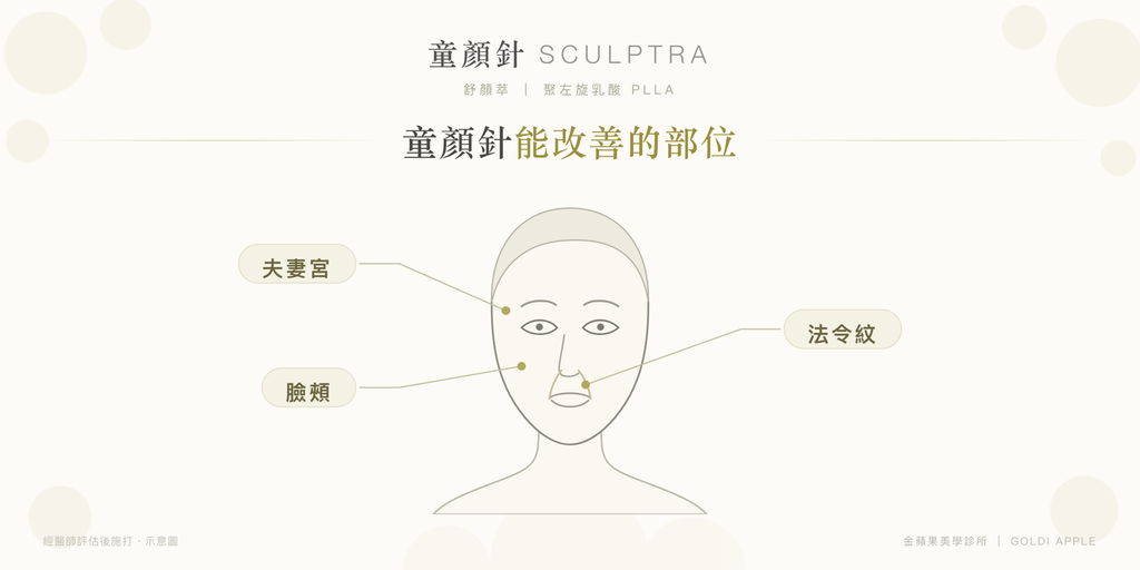童顏針改善部位