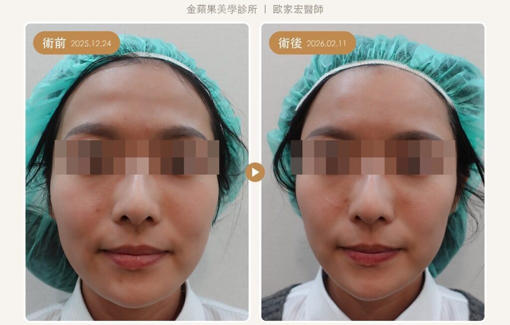晶亮瓷額頭