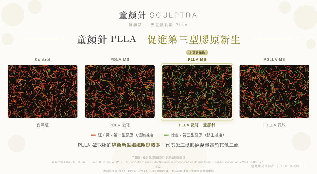 童顏針膠原蛋白增生效果