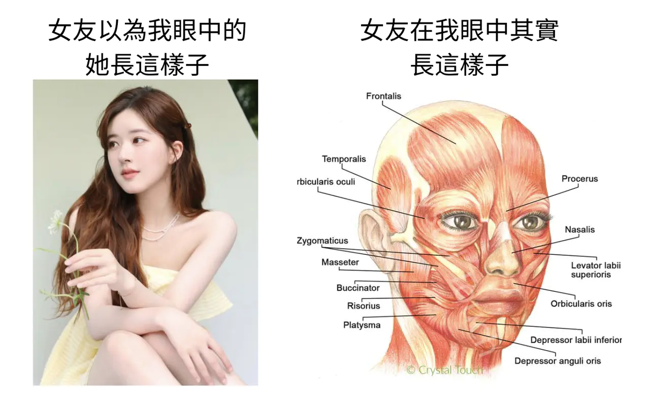淚溝玻尿酸品牌實測模特兒：各部位施打不同玻尿酸劑型對照圖