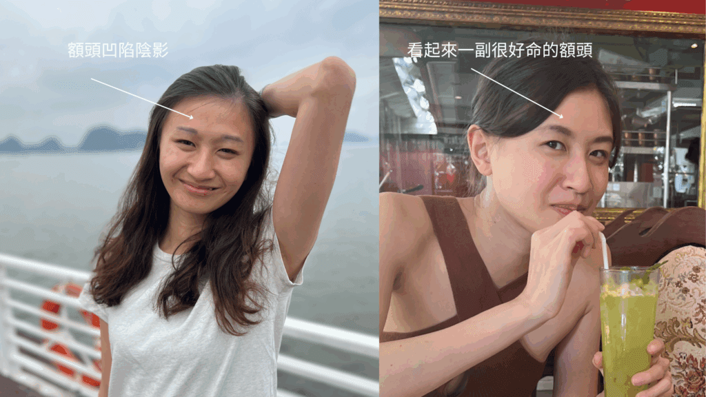 額頭凹陷與飽滿額頭對比：左圖額頭凹陷產生陰影，右圖額頭飽滿顯得好命