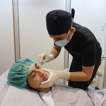醫師以23號鈍針為客人填補雙側淚溝玻尿酸